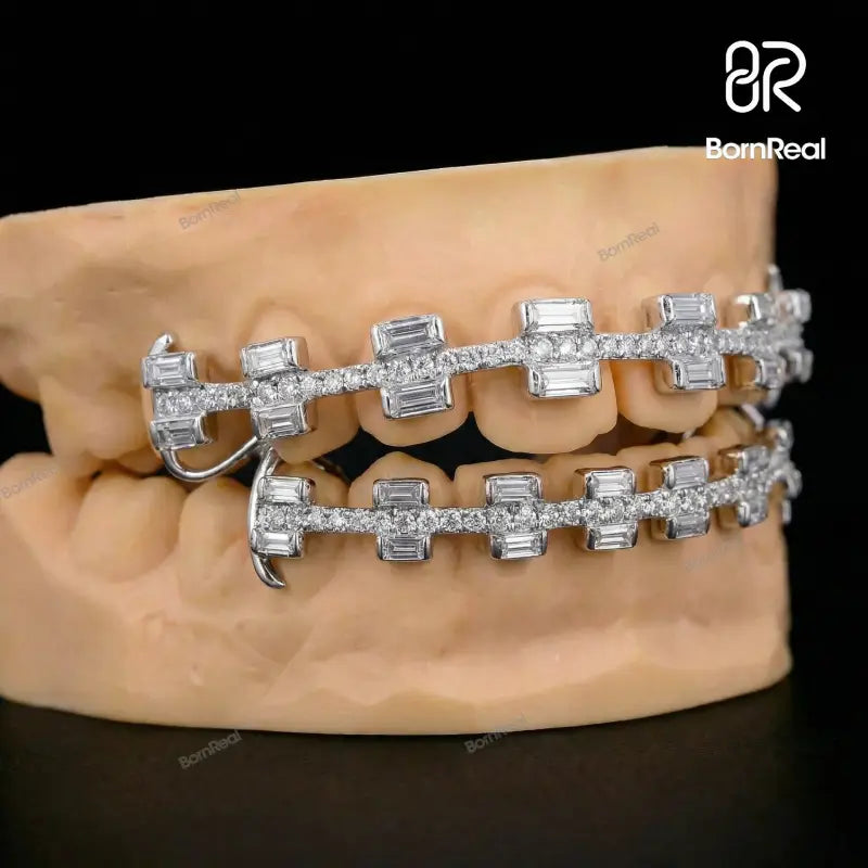 Custom Rectangular Cut Brace Style Grillz