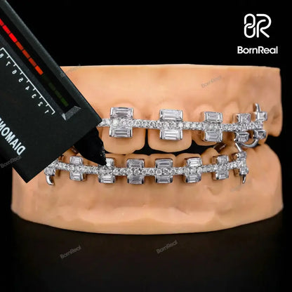 Custom Rectangular Cut Brace Style Grillz