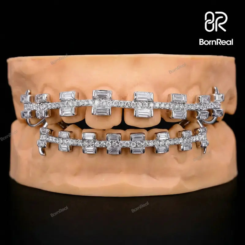 Custom Rectangular Cut Brace Style Grillz