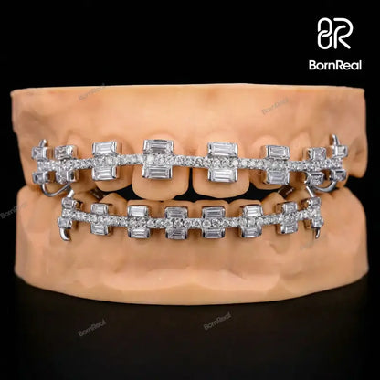 Custom Rectangular Cut Brace Style Grillz