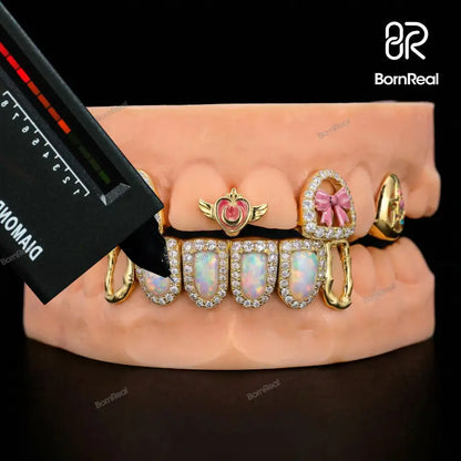 Custom Kitty & Opal Moissanite Diamond Grillz
