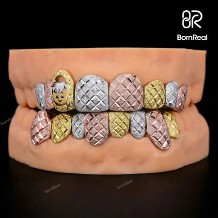 Custom Tri-Tone Diamond Dust And Diamond Cut Grillz