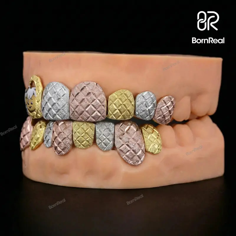 Custom Tri-Tone Diamond Dust And Diamond Cut Grillz