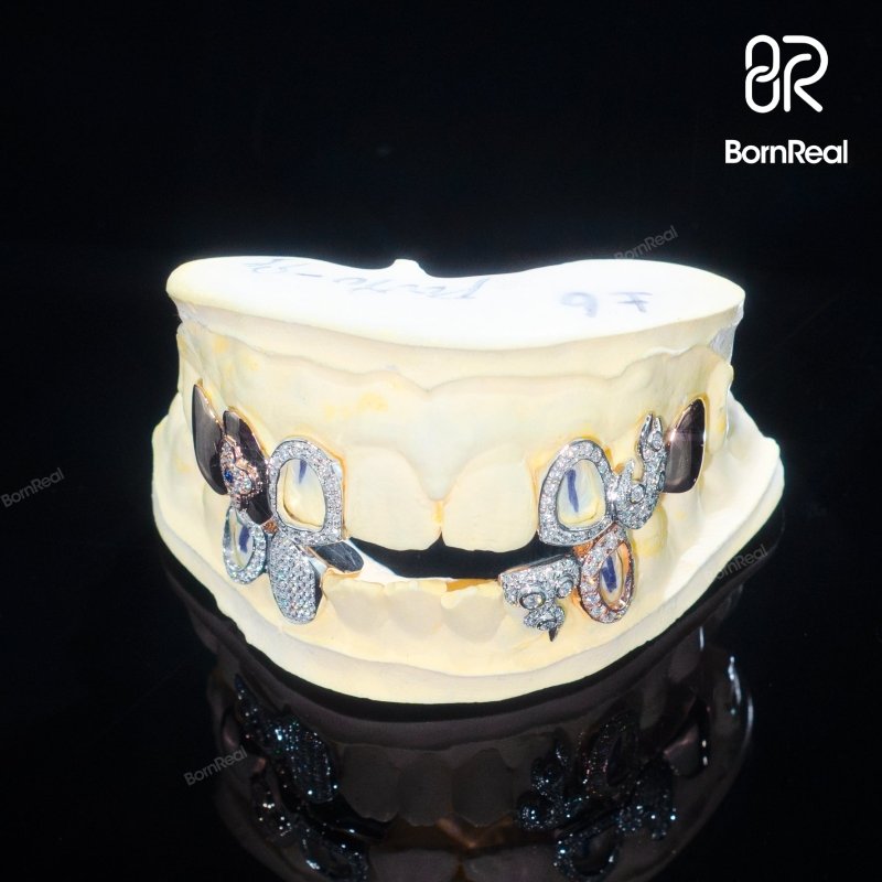 Custom Irregular Openwork Moissanite Grillz