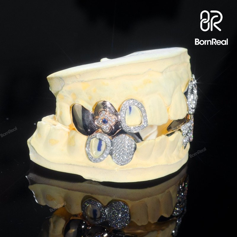 Custom Irregular Openwork Moissanite Grillz