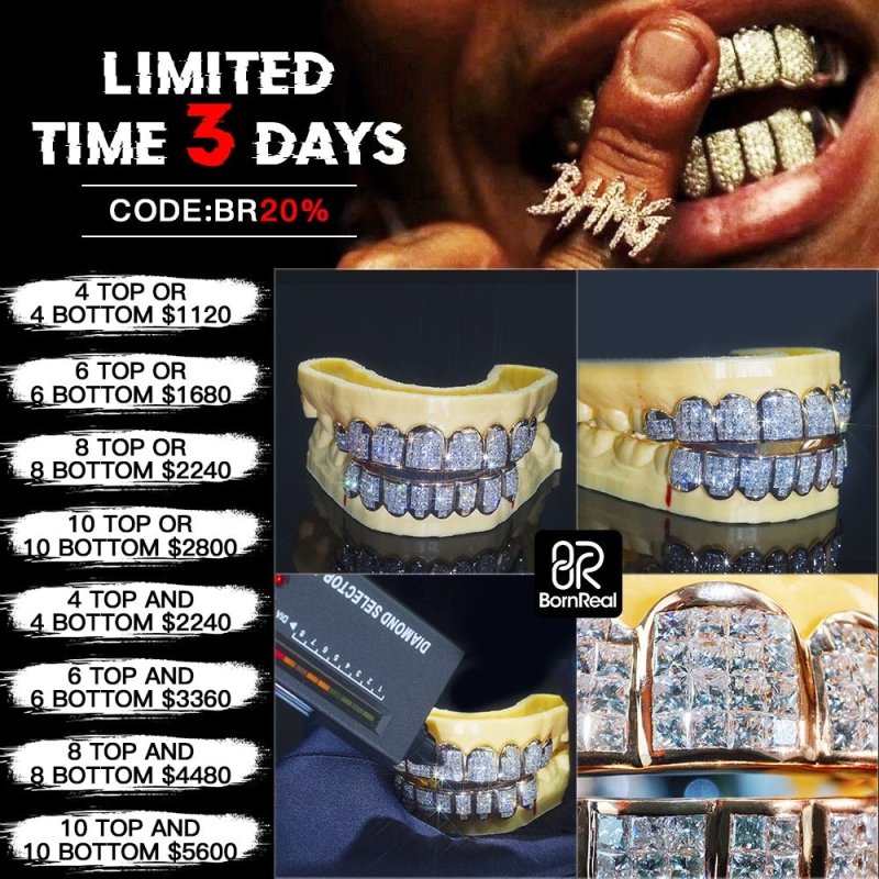 Deposit For Custom Grillz