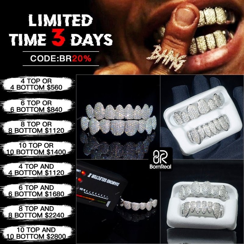 Deposit For Custom Grillz