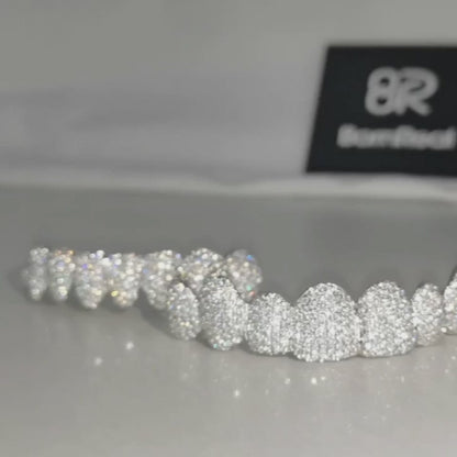 Custom VVS Moissanite  Diamond Grillz